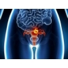 Лечение рака эндометрия (рака тела матки)  в Харбине